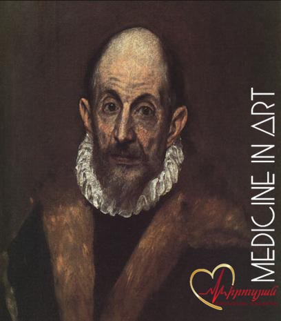 Ո՞ճ, թե՞ հիվանդություն. Էլ Գրեկոյի, Մոնեի ու Դեգայի արվեստի գաղտնիքը